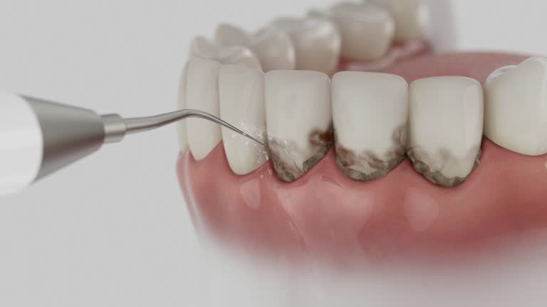 Reliable Dental Implants contractor in Cloverdale, VA by Smile Center Dentistry